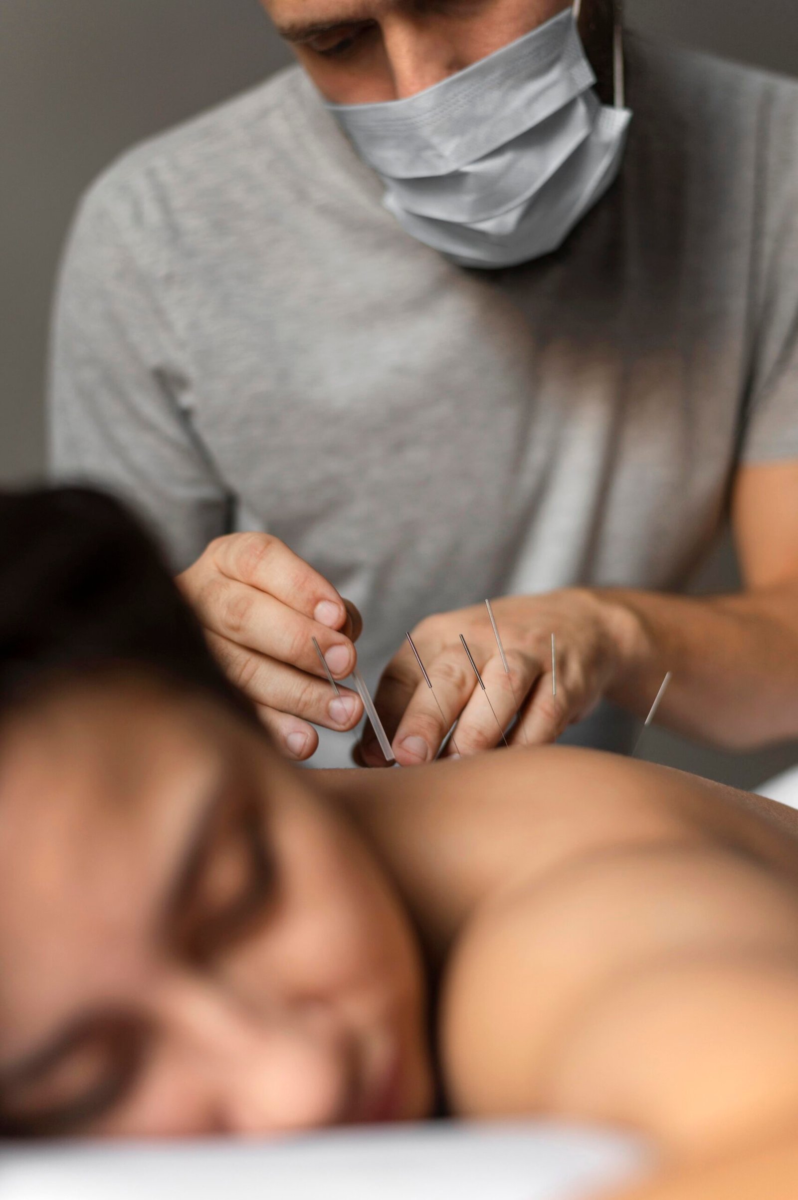 Acupuntura